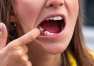 Skuteczne sposoby na braki zębowe. Uzupełnienia stałe i protezy wyjmowane