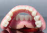 Jak przebiega wykonanie protezy zębowej?