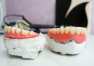 Czym wyróżniają się protezy częściowe ruchome nakładkowe (overdenture)? Pracownia Techniki Dentystycznej