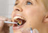 Zabiegi profilaktyczne jamy ustnej