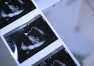Nowoczesne metody diagnostyki ginekologicznej w Gdańsku