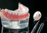 Dostępne technologie w produkcji wyrobów dentystycznych