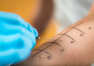 Testy skórne podstawowymi metodami wykrywania alergii