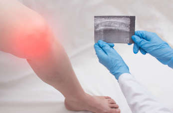 Co warto wiedzieć na temat choroby zwyrodnieniowej kolana?