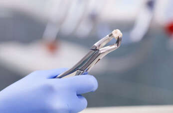 White Dental Clinic: Kiedy konieczne jest chirurgiczne usuwanie zębów?