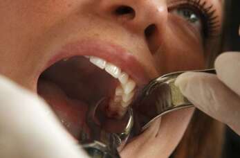 Gabinety Lekarskie Wołowiec: Chirurgiczne usuwanie zęba - kiedy jest konieczne i jak się przygotować