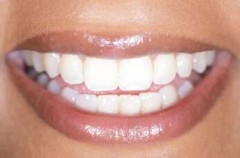 Skaling i piaskowanie zębów - czym są te zabiegi i kiedy można je stosować? | Nataliia Trotsiuk