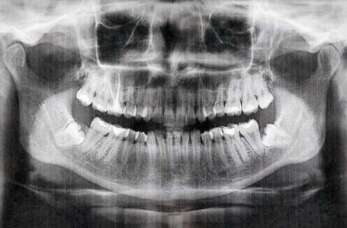 RTG zębów – komfortowe badanie w Dental Med