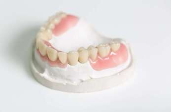 Mosty protetyczne – Ha-Dent Gabinet Stomatologiczny