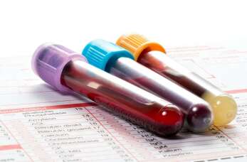 Szybkie testy diagnostyczne w medycynie pracy