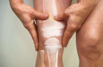 Jak wygląda zabieg endoprotezoplastyki kolana?