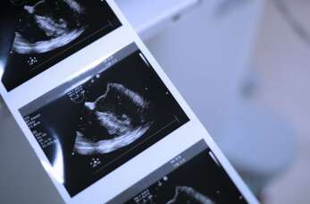 Nowoczesne metody diagnostyki ginekologicznej w Gdańsku