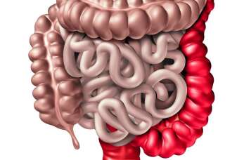 Krew w stolcu – poznaj przyczyny i metody diagnostyki