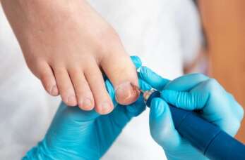 Wrastające paznokcie – przyczyny i leczenie w Mszczonowie